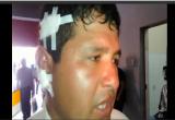 Percy Villalobos Guzmán (18) es uno de los sobrevivientes del terrible accidente de tránsito ocurrido en Huarmey. (Foto captura RPP)