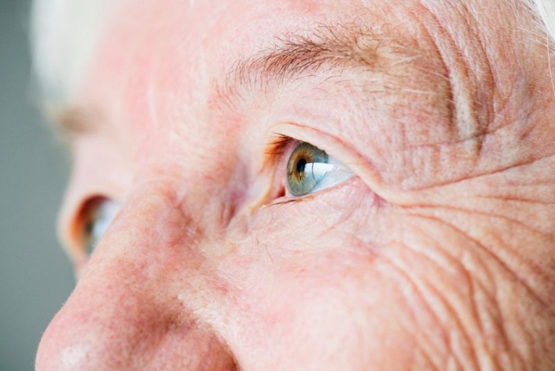 ¿Qué es el glaucoma? Causas, síntomas, diagnóstico, tratamiento