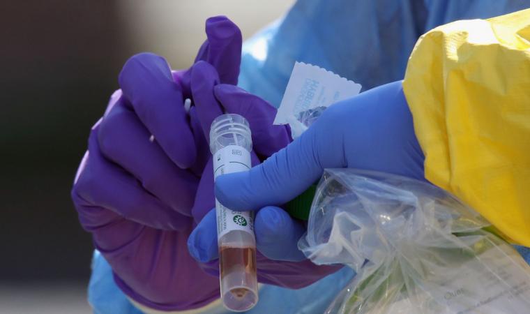 Coronavirus: asciende a 852 número de contagiados en el Perú