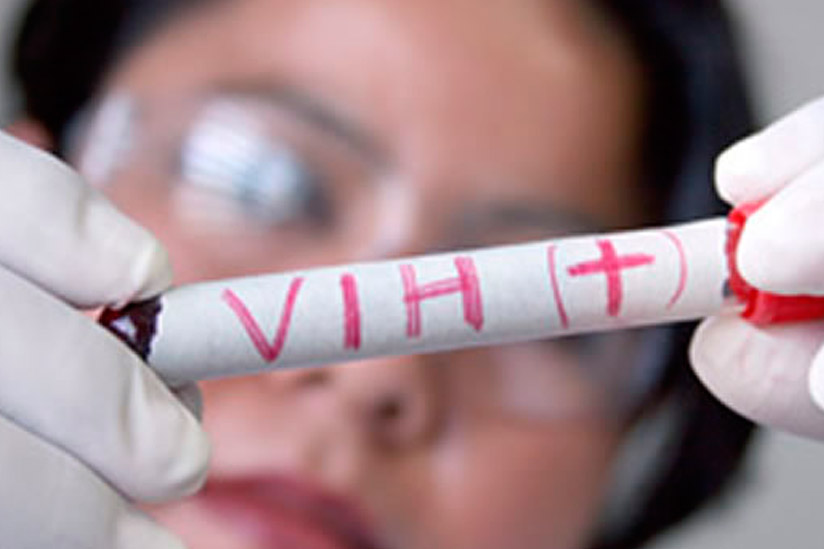  Se reportan 127 nuevos casos de VIH Sida en Lambayeque