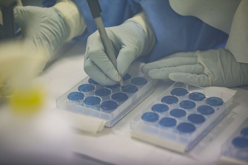 Coronavirus: científicos peruanos producirán gel que elimina 99% de virus y bacterias