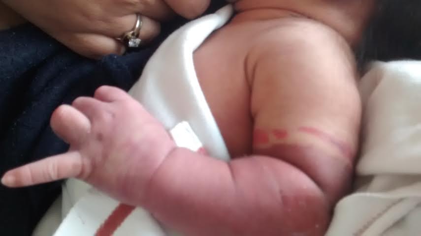 Acusan a enfermeras de dejar liga en bracito de recién nacido