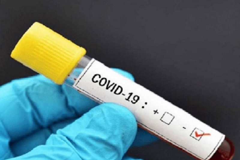  Estudio muestra que las muertes infantiles por covid-19 son excepcionales