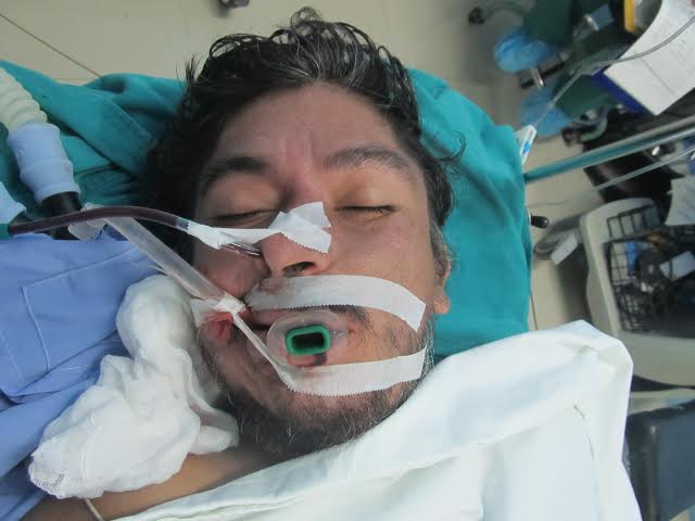 Atropellan a un hombre y dejan abandonado en la panamericana Norte