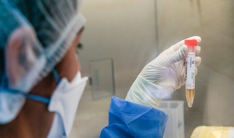 Minsa confirma primer caso de reinfección por covid-19 en el Perú