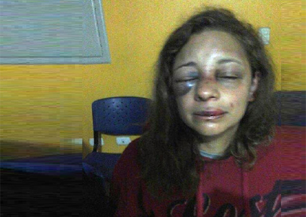 ¡El colmo! Sujeto que golpeó salvajemente a su pareja solo será investigado por  lesiones leves