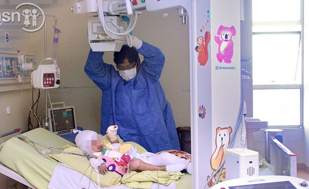 En fiestas de fin de año quemaduras a niños por pirotécnicos aumentan en 30%