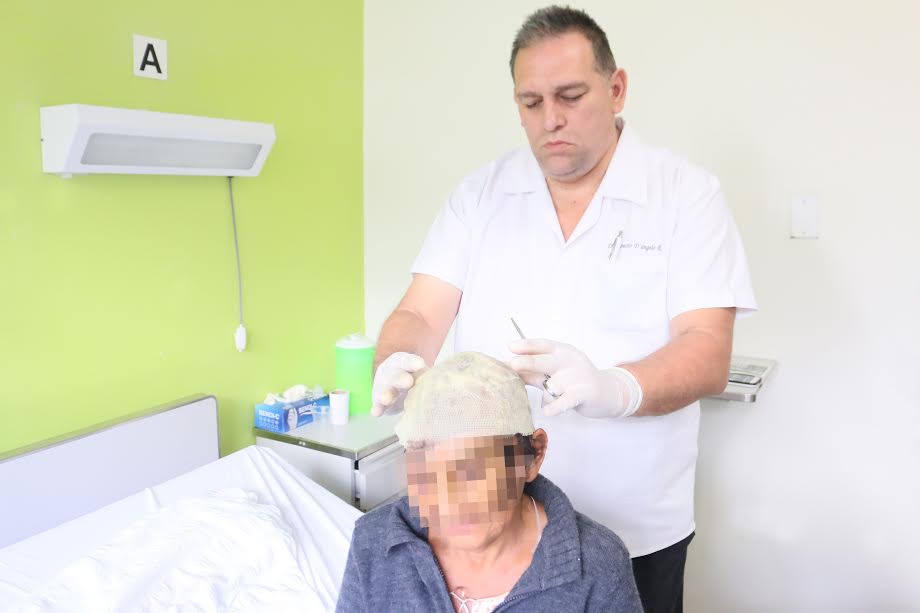 Lambayeque: médicos de Hospital Regional realizan con éxito injerto de cuero cabelludo