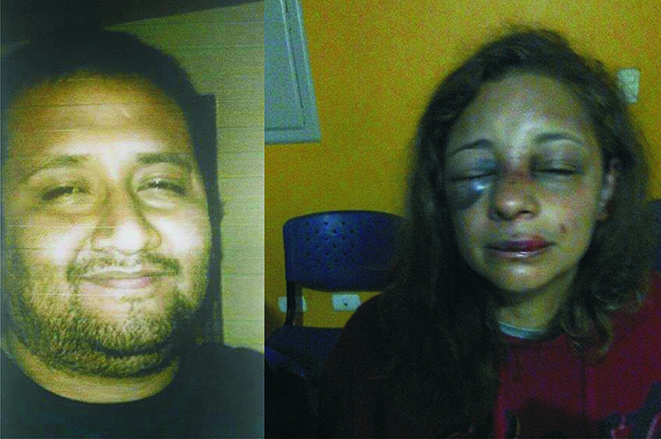 Humilde mujer fue gravemente golpeada por su pareja