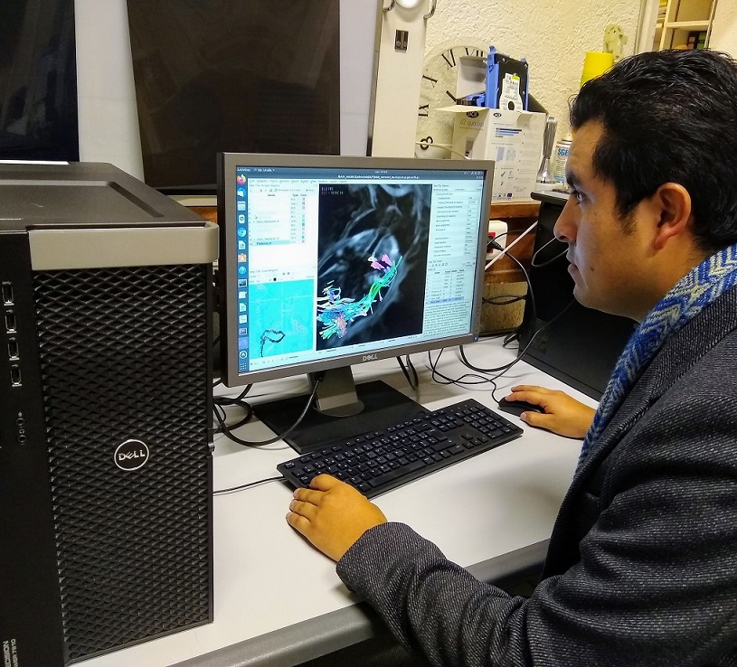 Nilser, el peruano que estudia en Francia para mejorar diagnóstico de sus connacionales 