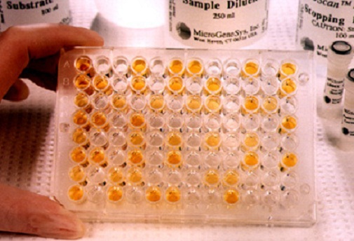 Estas son las 10 preguntas más comunes cuando una persona se hace una prueba de VIH