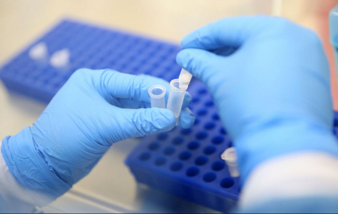 Caso sospechoso de zika en Lambayeque reportó Instituto Nacional de Salud